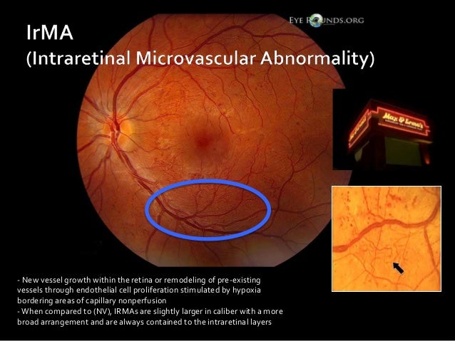 Diabetic Retinopathy A Clinical Survival Guide