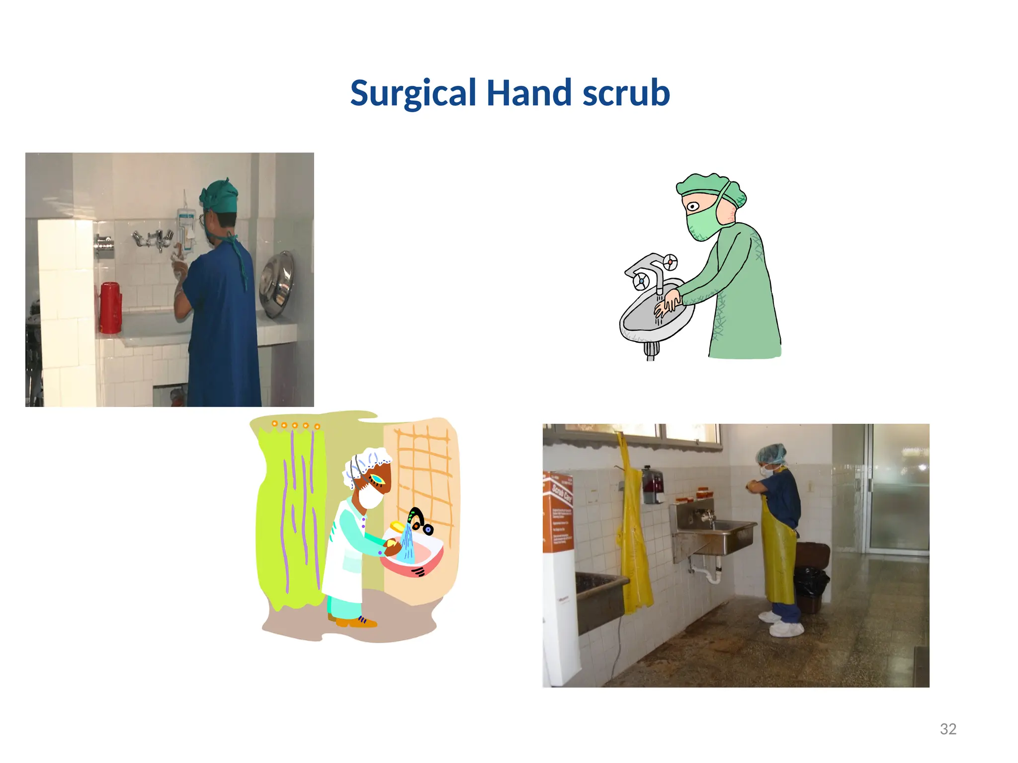 32
Surgical Hand scrub
 