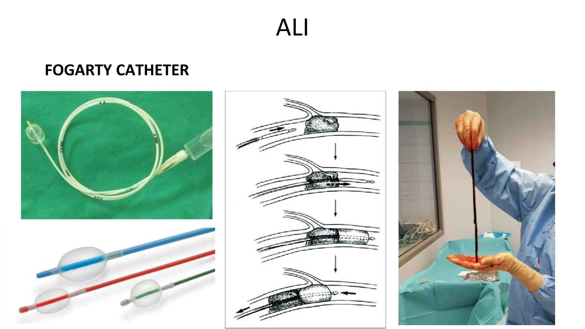 Diagnosis and treatment of lower extremity vascular diseases | PPTX