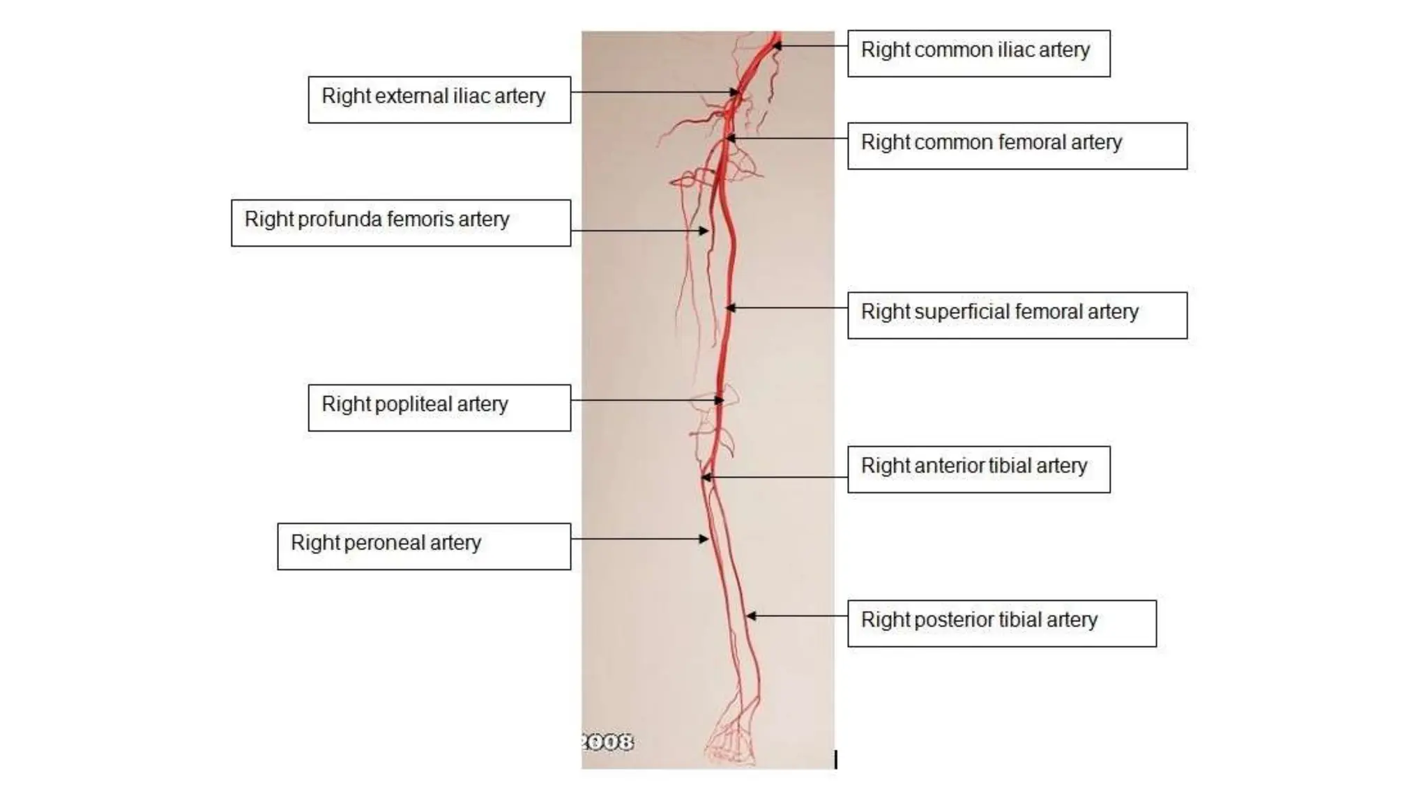Diagnosis and treatment of lower extremity vascular diseases | PPTX