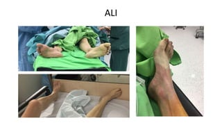 Diagnosis and treatment of lower extremity vascular diseases | PPTX