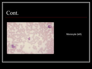 Cont.
Monocyte (left)
 