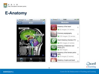 E-Anatomy




            14
 