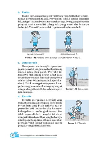 Orang Rakitis ILMU PENGETAHUAN ALAM UNTUK SD & MI KELAS 4 -- BUDI WAHYONO & SETYO ...
