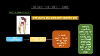 TREATMENT PROCEDURE
Toothshowingdeepcariouslesionadjacentto pulp
FIRST APPOINTMENT
Isolationwith
rubberdam
Establish
cavity outline
usinga high
speedhand
piece
Remove
superficial
debris andsoft
necrotic dentin
witha slow
speedhand
pieceusing
large round
burs-Do not
exposethe
pulp.
Local
Anesthesia
 