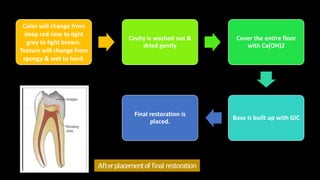 Color will change from
deep red rose to light
grey to light brown.
Texture will change from
spongy & wet to hard.
Cavity is washed out &
dried gently
Cover the entire floor
with Ca(OH)2
Base is built up with GIC
Final restoration is
placed.
Afterplacementof final restoration
 