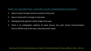 Frank has described four successful results of Apexification treatment's:
1. Apex is closed, through minimum recession of the canal
2. Apex is closed with no change in root space
3. Radiographically apparent calcific bridge at the apex
4. There is no radiographic evidence of apical closure, but upon clinical instrumentation,
there is definite stop at the apex, indicating calcific repair.
Dentistry for the Child and Adolescent- Ralph E. McDonald, David R. Avery, Jeffrey A. Dean.-8th ed.
 