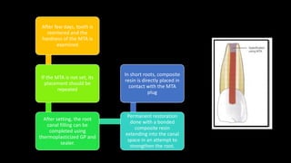 After few days, tooth is
reentered and the
hardness of the MTA is
examined
If the MTA is not set, its
placement should be
repeated
After setting, the root
canal filling can be
completed using
thermoplasticized GP and
sealer.
Permanent restoration
done with a bonded
composite resin
extending into the canal
space in an attempt to
strengthen the root.
In short roots, composite
resin is directly placed in
contact with the MTA
plug
 