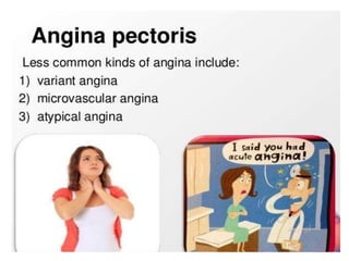 angina pectoris