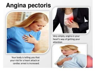 angina pectoris