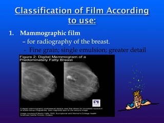 1. Mammographic film
– for radiography of the breast.
- Fine grain; single emulsion; greater detail
 