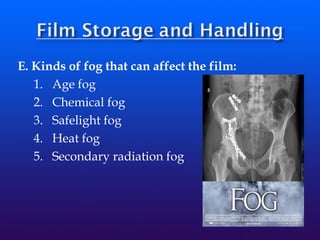 E. Kinds of fog that can affect the film:
1. Age fog
2. Chemical fog
3. Safelight fog
4. Heat fog
5. Secondary radiation fog
 