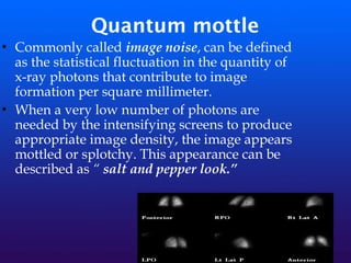 Quantum mottle
• Commonly called image noise, can be defined
as the statistical fluctuation in the quantity of
x-ray photons that contribute to image
formation per square millimeter.
• When a very low number of photons are
needed by the intensifying screens to produce
appropriate image density, the image appears
mottled or splotchy. This appearance can be
described as “ salt and pepper look.”
 