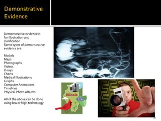 Demonstrative
Evidence

Demonstrative evidence is
for illustration and
clarification.
Some types of demonstrative
evidence are:

Models
Maps
Photographs
Videos
X-rays
Charts
Medical Illustrations
Graphs
Computer Animations
Timelines
Physical Photo Albums

All of the above can be done
using low or high technology.



                                38
 