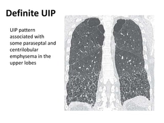 Uip Diffuse Pattern ipf2022.pptx