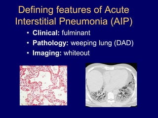 Defining features of Acute
Interstitial Pneumonia (AIP)
• Clinical: fulminant
• Pathology: weeping lung (DAD)
• Imaging: whiteout

 