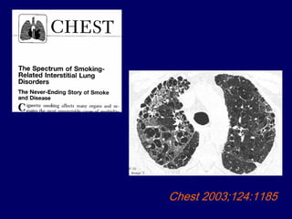 Chest 2003;124:1185

 