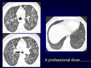 A professional diver..........

 