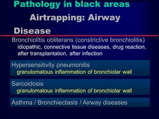Pathology in black areas
Airtrapping: Airway
Disease
Bronchiolitis obliterans (constrictive bronchiolitis)
idiopathic, connective tissue diseases, drug reaction,
after transplantation, after infection

Hypersensitivity pneumonitis
granulomatous inflammation of bronchiolar wall

Sarcoidosis
granulomatous inflammation of bronchiolar wall

Asthma / Bronchiectasis / Airway diseases

 