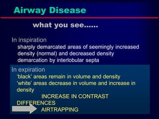Airway Disease
what you see……
In inspiration
sharply demarcated areas of seemingly increased
density (normal) and decreased density
demarcation by interlobular septa

In expiration
„black‟ areas remain in volume and density
„white‟ areas decrease in volume and increase in
density
INCREASE IN CONTRAST
DIFFERENCES
AIRTRAPPING

 