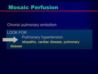 Mosaic Perfusion
Chronic pulmonary embolism

LOOK FOR
Pulmonary hypertension
idiopathic, cardiac disease, pulmonary
disease

 