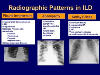 Radiographic Patterns in ILD
Pleural Involvement
Lymphangitic Carcinomatosis
LAM
Drug Induced
Radiation Pneumonitis
Asbestosis
Effusion
Thickening
Plaques
Mesothelioma
Collagen vascular disease

Adenopathy
Sarcoidosis
Lymphoma
Lymphangitic CA
LIP
Amyloidosis
Berylliosis
Silicosis

Kerley B lines
Chronic LV failure
Lymphangitic CA
Lymphoma
LAM
Veno-occlusive disease
Acute Eosinophilic Pneumonia

 