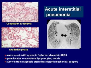 Acute interstitial
pneumonia
Congestion & oedema

Exudative phase
acute onset, with systemic features: idiopathic ARDS
 granulocytes + occasional lymphocytes; debris
 survival from diagnosis often days despite mechanical support


 