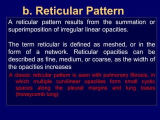 b. Reticular Pattern
A reticular pattern results from the summation or
superimposition of irregular linear opacities.
The term reticular is defined as meshed, or in the
form of a network. Reticular opacities can be
described as fine, medium, or coarse, as the width of
the opacities increases.
A classic reticular pattern is seen with pulmonary fibrosis, in
which multiple curvilinear opacities form small cystic
spaces along the pleural margins and lung bases
(honeycomb lung)

 
