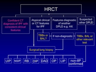 HRCT
Confident CT
diagnosis of IPF with
consistent clinical
features

Atypical clinical
or CT features
for IPF
TBBx or
BAL?

Features diagnostic
of another
DPLD e.g. HX

If non-diagnostic

Suspected
other DPLD

TBBx, BAL or
other relevant
test

Surgical lung biopsy

UIP

NSIP

RB

DIP DAD

OP

LIP

non-IIP
confirmed

 