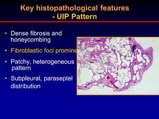 Key histopathological features
- UIP Pattern
• Dense fibrosis and
honeycombing
• Fibroblastic foci prominent
• Patchy, heterogeneous
pattern
• Subpleural, paraseptel
distribution

 