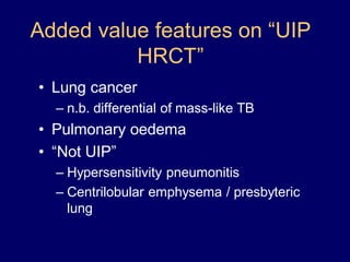 Added value features on “UIP
HRCT”
• Lung cancer
– n.b. differential of mass-like TB

• Pulmonary oedema
• “Not UIP”
– Hypersensitivity pneumonitis
– Centrilobular emphysema / presbyteric
lung

 