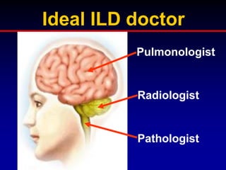 Ideal ILD doctor
Pulmonologist

Radiologist

Pathologist

 