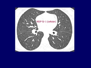 NSIP Gr 1 (cellular)

 