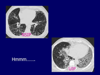 NSIP

Hmmm…….
UIP

 