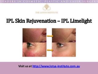 Visit us at http://www.lotus-institute.com.au
IPL Skin Rejuvenation – IPL Limelight
 