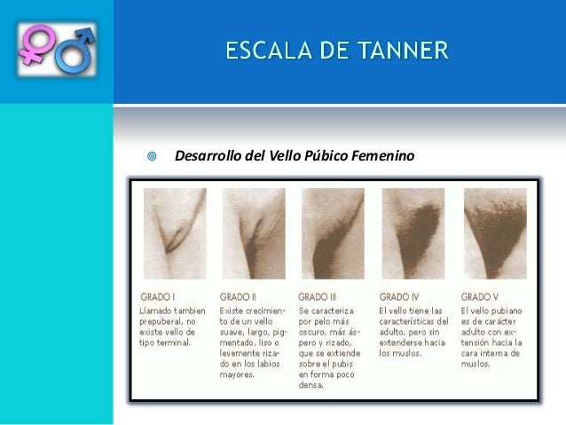 Tamano de la vagina — photo 4