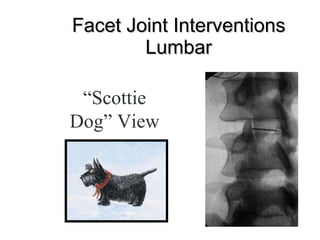 Facet Joint Interventions Lumbar “ Scottie Dog” View 