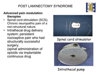 POST LAMINECTOMY SYNDROME Advanced pain modulation therapies Spinal cord stimulation (SCS); Chronic neuropathic pain of a non-structural nature *  Intrathecal drug delivery system; persistent nociceptive pain who had structurally successful surgery.  (spinal administration of opioids via implantable continuous drug   Spinal cord stimulator Intrathecal pump 
