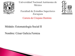 Módulo: Estomatología Social II
Nombre: César Galicia Ferniza
Carrera de Cirujano Dentista
 