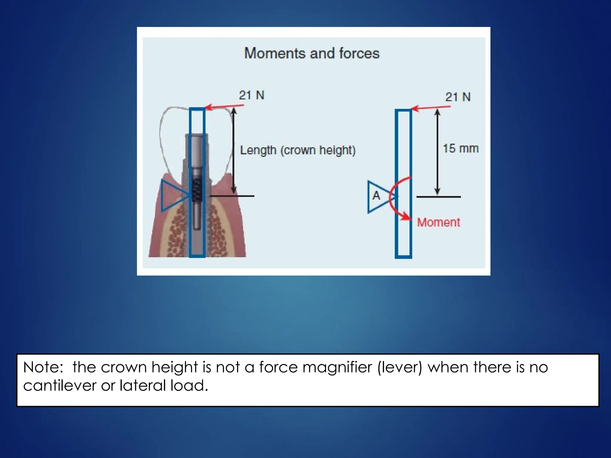 implant protective occlusion in prosthodontics | PPTX
