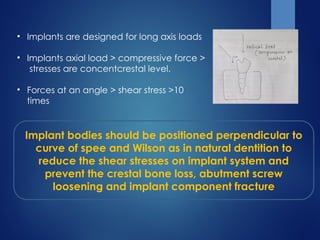 • Implants are designed for long axis loads
• Implants axial load > compressive force >
stresses are concentcrestal level.
• Forces at an angle > shear stress >10
times
Implant bodies should be positioned perpendicular to
curve of spee and Wilson as in natural dentition to
reduce the shear stresses on implant system and
prevent the crestal bone loss, abutment screw
loosening and implant component fracture
 