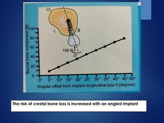 The risk of crestal bone loss is increased with an angled implant
 