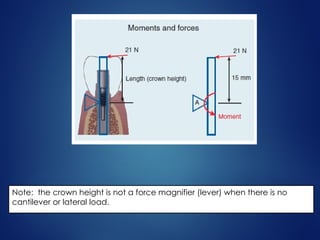 Note: the crown height is not a force magnifier (lever) when there is no
cantilever or lateral load.
 