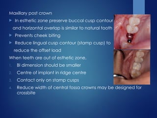 Maxillary post crown
 In esthetic zone preserve buccal cusp contour
and horizontal overlap is similar to natural tooth
 Prevents cheek biting
 Reduce lingual cusp contour (stamp cusp) to
reduce the offset load
When teeth are out of esthetic zone,
1. Bl dimension should be smaller
2. Centre of implant in ridge centre
3. Contact only on stamp cusps
4. Reduce width of central fossa crowns may be designed for
crossbite
 