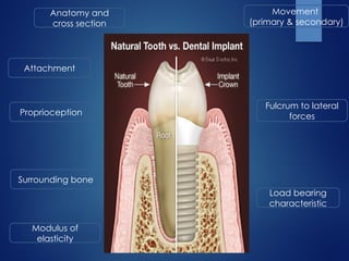 Attachment
Proprioception
Load bearing
characteristic
Fulcrum to lateral
forces
Modulus of
elasticity
Movement
(primary & secondary)
Anatomy and
cross section
Surrounding bone
 