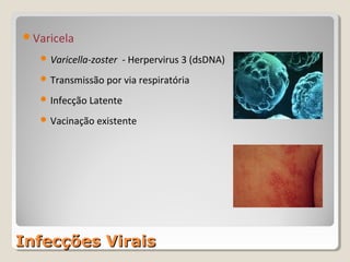 Varicela

    Varicella-zoster   - Herpervirus 3 (dsDNA)
    Transmissão por via respiratória

    Infecção Latente

    Vacinação existente




Infecções Virais
 