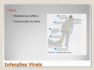 Raiva

   Rhabdovirus (ssRNA-)

   Transmisssão via saliva




Infecções Virais
 