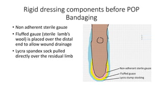 Rigid dressing components before POP
Bandaging
• Non adherent sterile gauze
• Fluffed gauze (sterile lamb’s
wool) is placed over the distal
end to allow wound drainage
• Lycra spandex sock pulled
directly over the residual limb
 