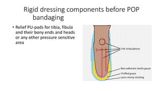 Rigid dressing components before POP
bandaging
• Relief PU-pads for tibia, fibula
and their bony ends and heads
or any other pressure sensitive
area
 