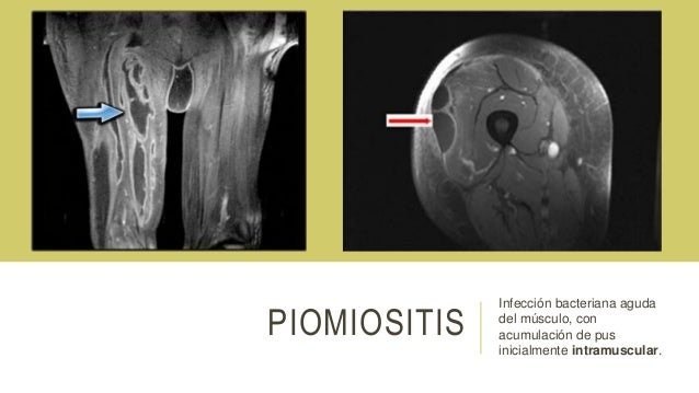 La osteocondrosis sheynogo del departamento como curarle por el medio público